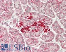 PCCB Antibody - Human Pancreas: Formalin-Fixed, Paraffin-Embedded (FFPE)
