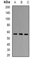PCCB Antibody - Western blot analysis of PCCB expression in HT29 (A); mouse liver (B); mouse heart (C) whole cell lysates.
