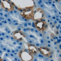 PCCB Antibody - Immunohistochemical analysis of PCCB staining in human kidney formalin fixed paraffin embedded tissue section. The section was pre-treated using heat mediated antigen retrieval with sodium citrate buffer (pH 6.0). The section was then incubated with the antibody at room temperature and detected using an HRP conjugated compact polymer system. DAB was used as the chromogen. The section was then counterstained with hematoxylin and mounted with DPX.