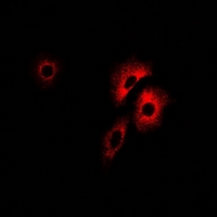 PCCB Antibody - Immunofluorescent analysis of PCCB staining in U2OS cells. Formalin-fixed cells were permeabilized with 0.1% Triton X-100 in TBS for 5-10 minutes and blocked with 3% BSA-PBS for 30 minutes at room temperature. Cells were probed with the primary antibody in 3% BSA-PBS and incubated overnight at 4 deg C in a humidified chamber. Cells were washed with PBST and incubated with a DyLight 594-conjugated secondary antibody (red) in PBS at room temperature in the dark.