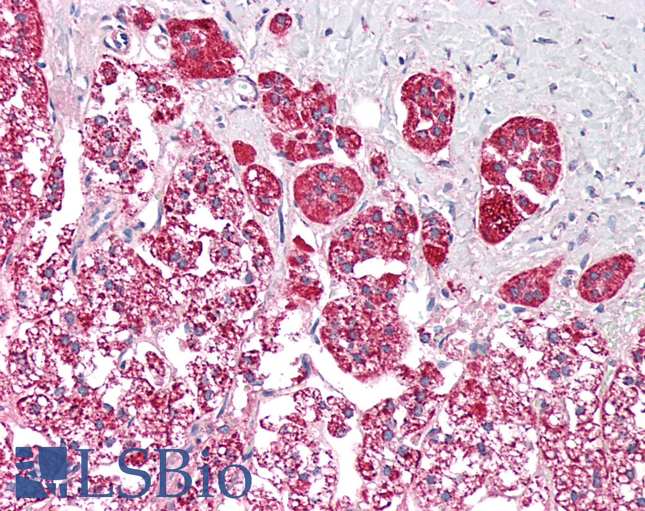 PCCB Antibody - Human Adrenal: Formalin-Fixed, Paraffin-Embedded (FFPE)