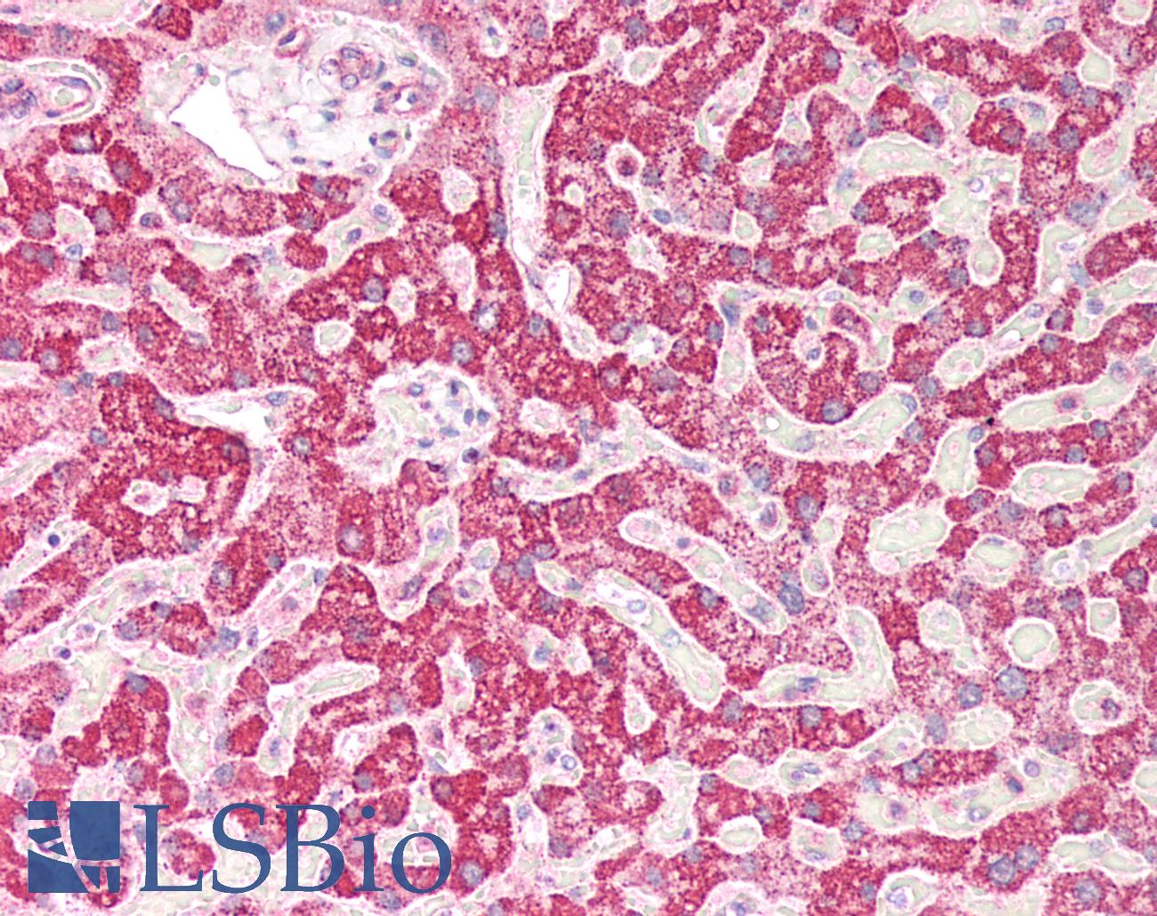 PCCB Antibody - Human Liver: Formalin-Fixed, Paraffin-Embedded (FFPE)