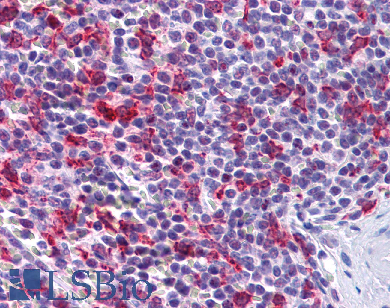 PCDH12 / VE-Cadherin-2 Antibody - Anti-PCDH12 antibody IHC of human spleen. Immunohistochemistry of formalin-fixed, paraffin-embedded tissue after heat-induced antigen retrieval. Antibody concentration 5 ug/ml.