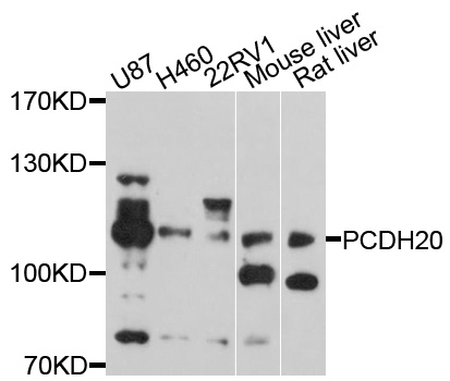 PCDH20 Antibody - Western blot analysis of extracts of various cell lines, using PCDH20 antibody at 1:1000 dilution. The secondary antibody used was an HRP Goat Anti-Rabbit IgG (H+L) at 1:10000 dilution. Lysates were loaded 25ug per lane and 3% nonfat dry milk in TBST was used for blocking. An ECL Kit was used for detection and the exposure time was 90s.