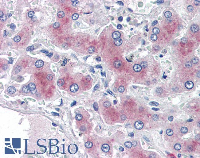 PCK1 Antibody - Anti-PCK1 antibody IHC of human liver. Immunohistochemistry of formalin-fixed, paraffin-embedded tissue after heat-induced antigen retrieval. Antibody concentration 2 ug/ml.