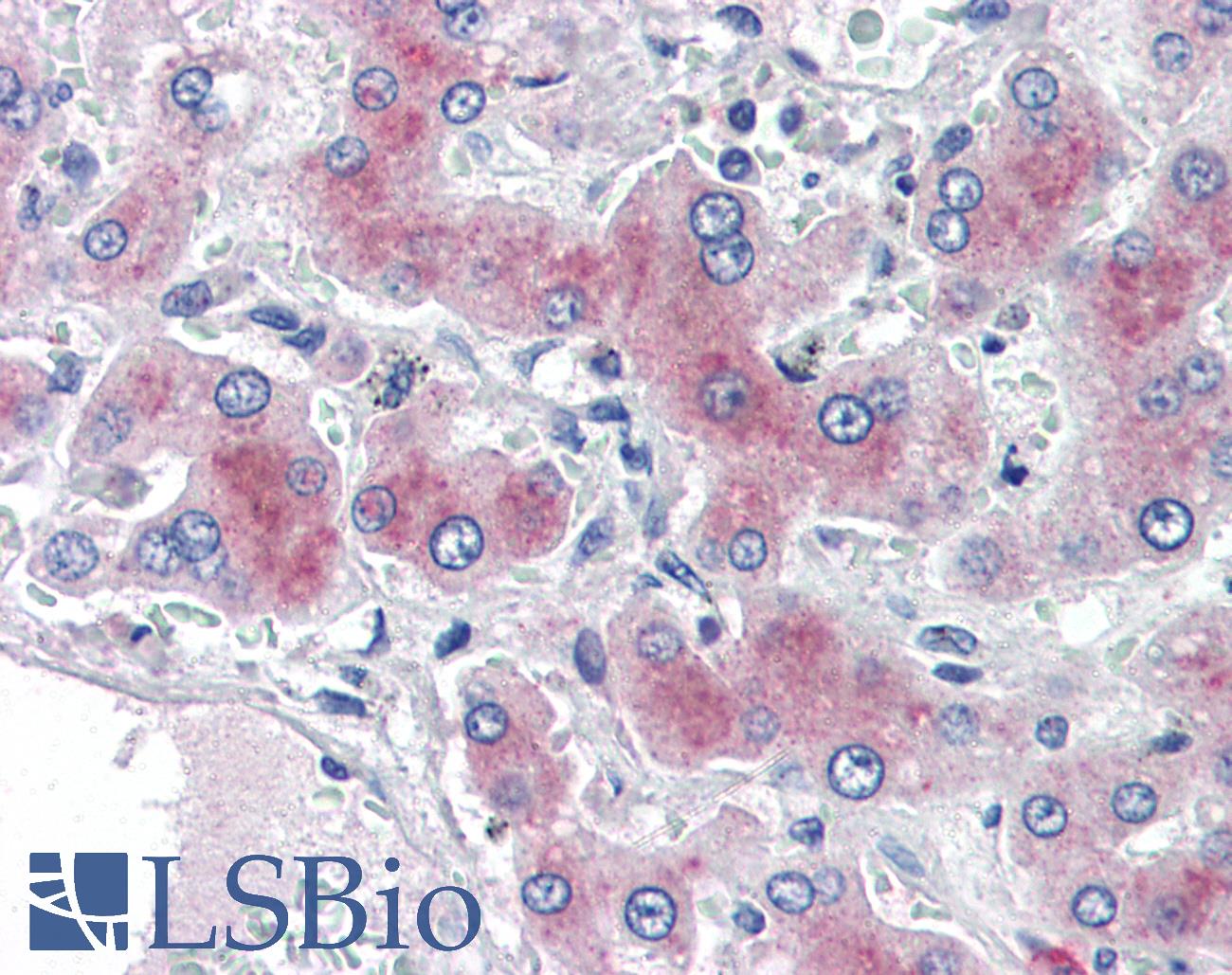 PCK1 Antibody - Anti-PCK1 antibody IHC of human liver. Immunohistochemistry of formalin-fixed, paraffin-embedded tissue after heat-induced antigen retrieval. Antibody concentration 2 ug/ml.