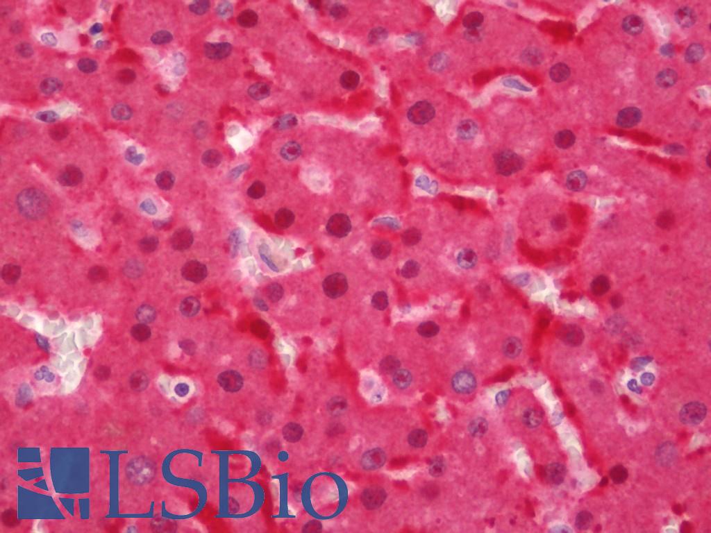 PCK1 Antibody - Human Liver: Formalin-Fixed, Paraffin-Embedded (FFPE).  This image was taken for the unconjugated form of this product. Other forms have not been tested.