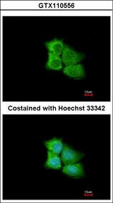 PCMT1 Antibody - Immunofluorescence of methanol-fixed A431 using PCMT1 antibody at 1:200 dilution.