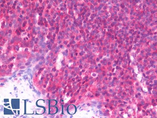 PCMT1 Antibody - Anti-PCMT1 antibody IHC staining of human tonsil. Immunohistochemistry of formalin-fixed, paraffin-embedded tissue after heat-induced antigen retrieval. Antibody concentration 7.5 ug/ml.