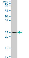PCMT1 Antibody - PCMT1 monoclonal antibody (M01), clone 4G9 Western Blot analysis of PCMT1 expression in PC-12.