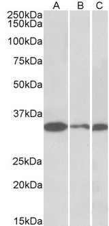 PCNA Antibody - PCNA antibody (0.01 ug/ml) staining of NIH3T3 (A), Mouse Testis (B) and Rat Testis (C) lysates (35 ug protein in RIPA buffer). Primary incubation was 1 hour. Detected by chemiluminescence.