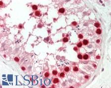 PCNA Antibody - Human Testis: Formalin-Fixed, Paraffin-Embedded (FFPE)