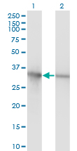 PCNA Antibody - Western Blot analysis of PCNA expression in transfected 293T cell line by PCNA monoclonal antibody (M02), clone 1G7.Lane 1: PCNA transfected lysate(28.8 KDa).Lane 2: Non-transfected lysate.