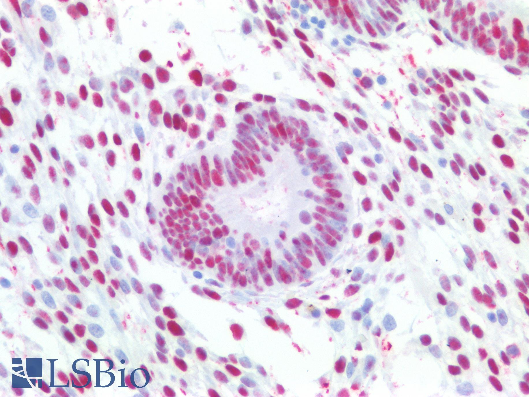 PCNA Antibody - Human Uterus: Formalin-Fixed, Paraffin-Embedded (FFPE)