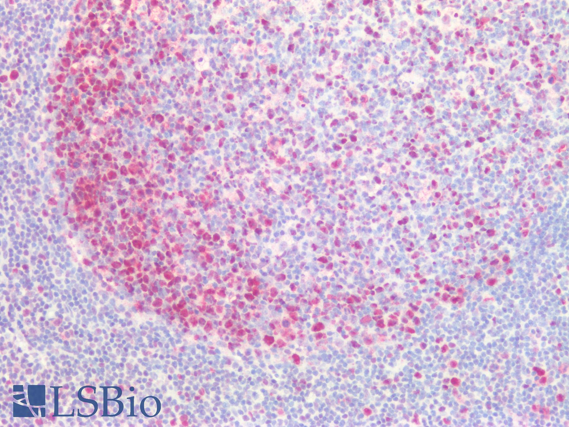 PCNA Antibody - Human Tonsil: Formalin-Fixed, Paraffin-Embedded (FFPE)
