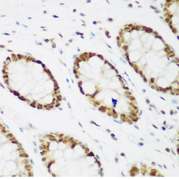 PCNA Antibody - Immunohistochemistry of paraffin-embedded human colon tissue, at a dilution of 1:200.