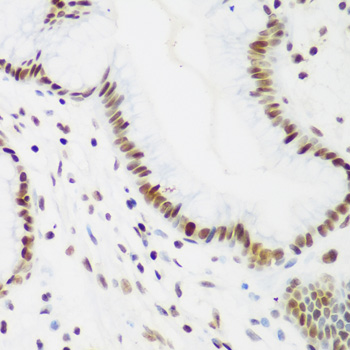 PCNA Antibody - Immunohistochemistry of paraffin-embedded human gastric tissue, at a dilution of 1:200.