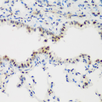 PCNA Antibody - Immunohistochemistry of paraffin-embedded mouse lung tissue, at a dilution of 1:200.