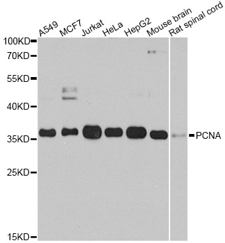 PCNA Antibody - Western blot analysis of extracts of various cell lines, using PCNA antibody at 1:1000 dilution. The secondary antibody used was an HRP Goat Anti-Rabbit IgG (H+L) at 1:10000 dilution. Lysates were loaded 25ug per lane and 3% nonfat dry milk in TBST was used for blocking. An ECL Kit was used for detection and the exposure time was 60s.