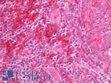 PCNA-Associated Factor Antibody - Human Tonsil: Formalin-Fixed, Paraffin-Embedded (FFPE).  This image was taken for the unconjugated form of this product. Other forms have not been tested.