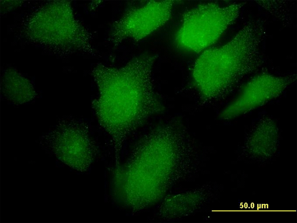 PCSK1 Antibody - Immunofluorescence of monoclonal antibody to PCSK1 on HeLa cell. [antibody concentration 30 ug/ml]