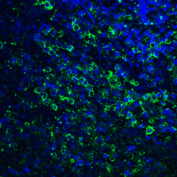 PD-L2 / PDCD1LG2 / CD273 Antibody - Immunofluorescence of PD-L2 in human tonsil tissue with PD-L2 antibody at 20 ug/mL. Green: PDL2 Antibody [4E10] Blue: DAPI staining