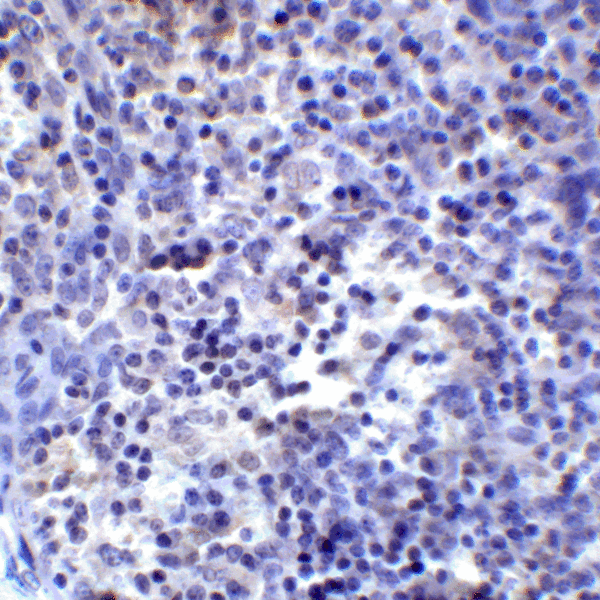 PD-L2 / PDCD1LG2 / CD273 Antibody - Immunohistochemistry of PD-L2 in human tonsil tissue with PD-L2 antibody at 2 ug/mL.