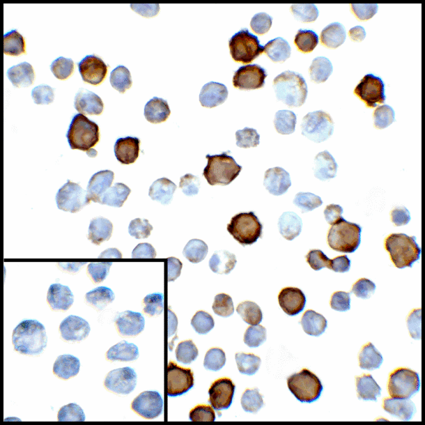 PD-L2 / PDCD1LG2 / CD273 Antibody - Immunocytochemistry of PD-L2 in transfected HEK293 cells with PD-L2 antibody at 5 ug/mL. Lower left: Immunocytochemistry in transfected HEK293 cells with control mouse IgG antibody at 5 ug/mL.