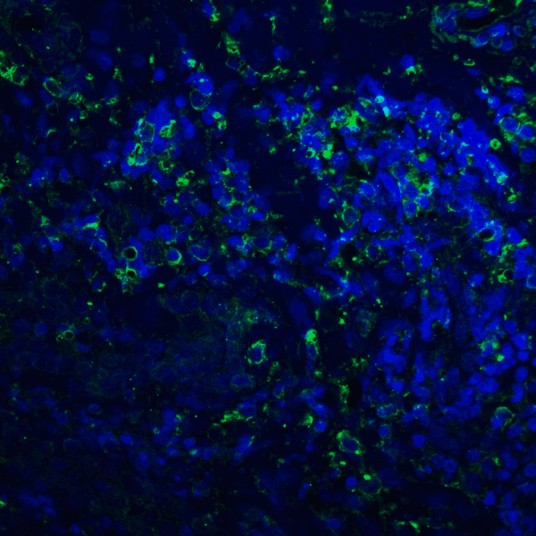 PD-L2 / PDCD1LG2 / CD273 Antibody - Immunofluorescence of PD-L2 in human tonsil tissue with PD-L2 antibody at 20 ug/mL. Green: PDL2 Antibody [8C12] Blue: DAPI staining
