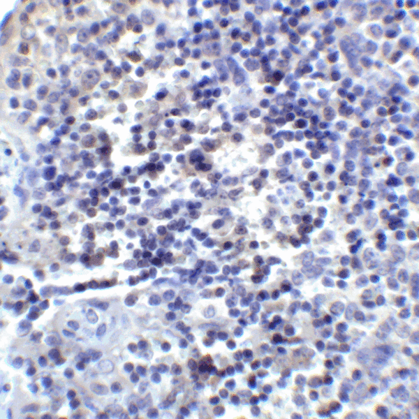 PD-L2 / PDCD1LG2 / CD273 Antibody - Immunohistochemistry of PD-L2 in human tonsil tissue with PD-L2 antibody at 2 ug/mL.