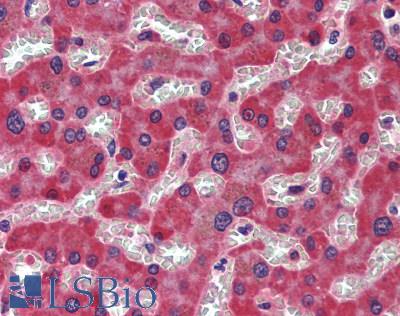 PD-L2 / PDCD1LG2 / CD273 Antibody - Human Liver: Formalin-Fixed, Paraffin-Embedded (FFPE)