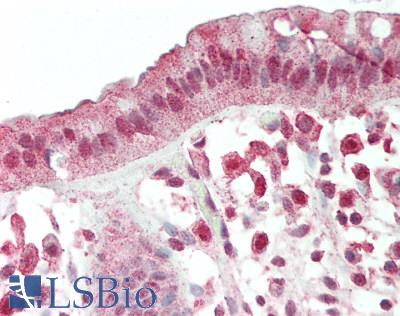 PD2 / PAF1 Antibody - Human Colon: Formalin-Fixed, Paraffin-Embedded (FFPE)