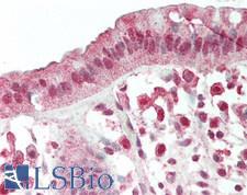PD2 / PAF1 Antibody - Human Colon: Formalin-Fixed, Paraffin-Embedded (FFPE)