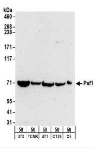 PD2 / PAF1 Antibody - Detection of Mouse and Rat Paf1 by Western Blot. Samples: Whole cell lysate (50 ug) from NIH3T3, TCMK-1, 4T1, CT26.WT, and rat C6 cells. Antibodies: Affinity purified rabbit anti-Paf1 antibody used for WB at 0.2 ug/ml. Detection: Chemiluminescence with an exposure time of 3 minutes.