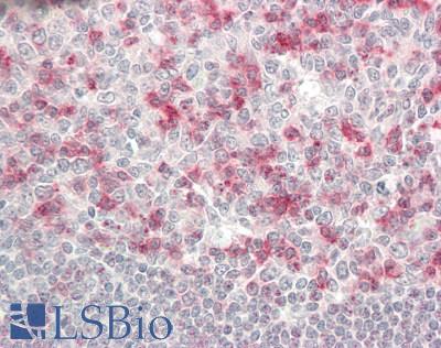 PDCD1 / CD279 / PD-1 Antibody - Human Tonsil: Formalin-Fixed, Paraffin-Embedded (FFPE)