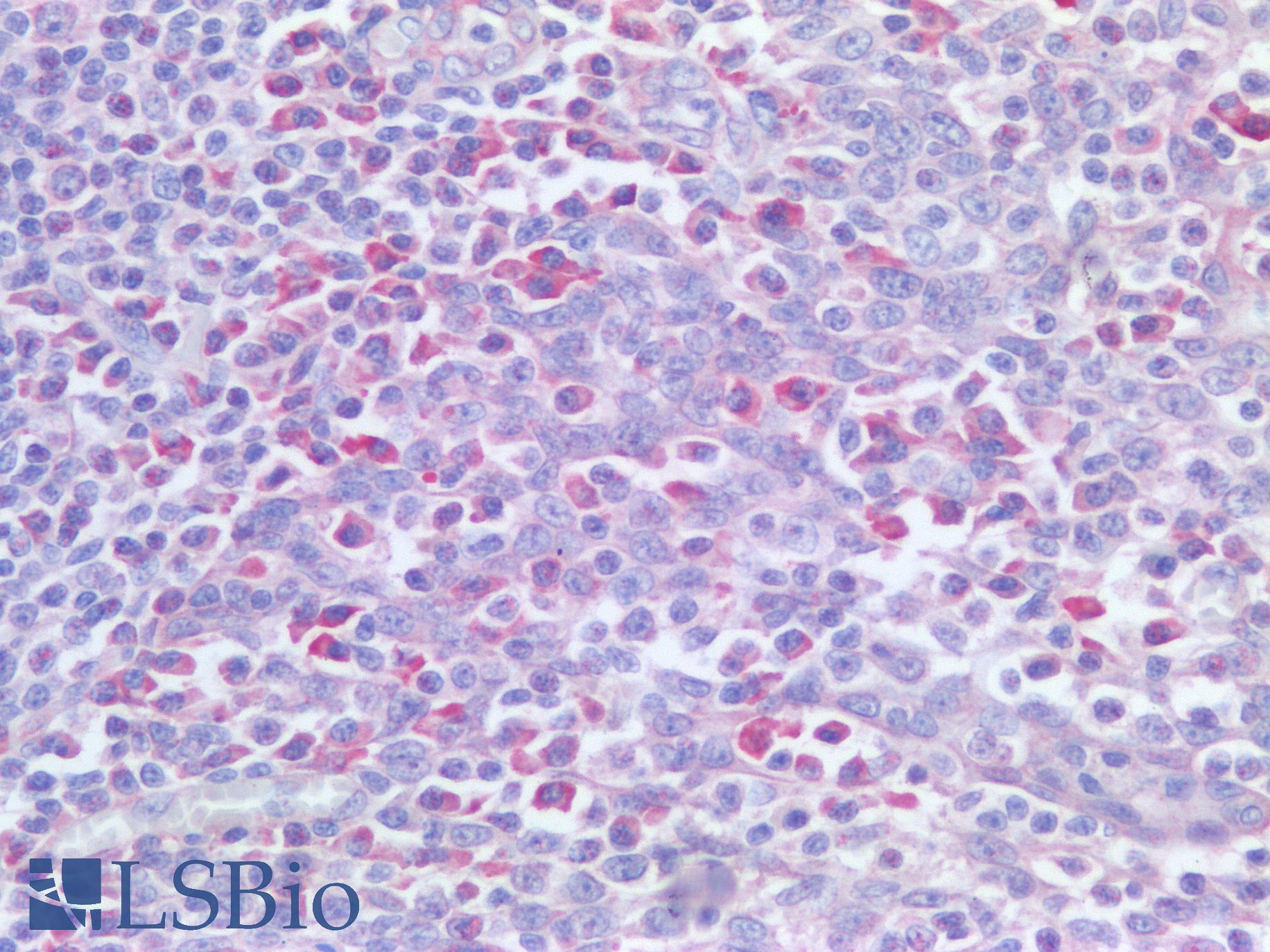PDCD1 / CD279 / PD-1 Antibody - Human Tonsil: Formalin-Fixed, Paraffin-Embedded (FFPE)