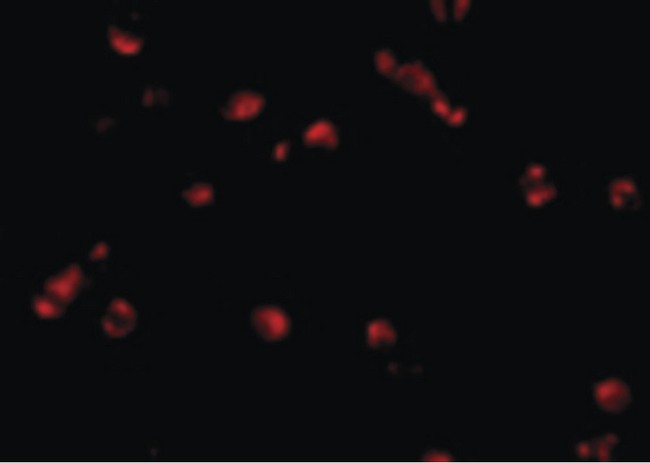 PDCD5 Antibody - Immunofluorescence of PDCD5 in Jurkat cells with PDCD5 antibody at 10 ug/ml.