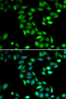 PDCD6 / ALG-2 Antibody - Immunofluorescence analysis of HeLa cell using PDCD6 antibody. Blue: DAPI for nuclear staining.