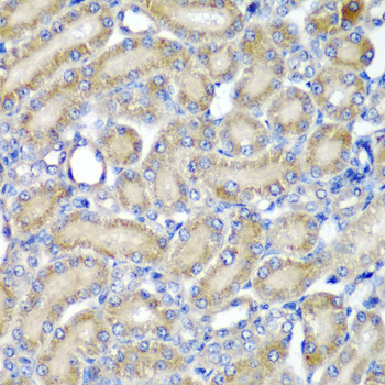 PDCD6 / ALG-2 Antibody - Immunohistochemistry of paraffin-embedded rat kidney tissue, at a dilution of 1:200. 