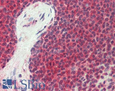 PDCD6 / ALG-2 Antibody - Human Spleen: Formalin-Fixed, Paraffin-Embedded (FFPE), at a dilution of 1:100. 