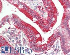 PDCD6IP / ALIX Antibody - Human Small Intestine: Formalin-Fixed, Paraffin-Embedded (FFPE)