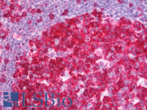 PDCL3 Antibody - Human Tonsil: Formalin-Fixed, Paraffin-Embedded (FFPE) 