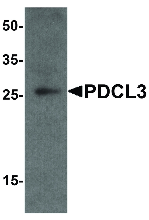 PDCL3 Antibody - Western blot analysis of PDCL3 in human brain tissue lysate with PDCL3 antibody at 1 ug/ml.
