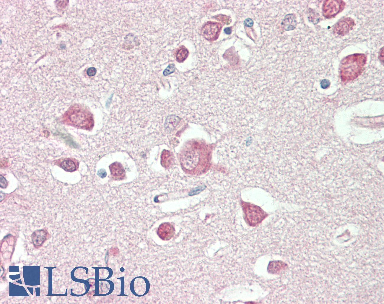 PDE2A Antibody - Anti-PDE2 / PDE2A antibody IHC staining of human brain, cortex. Immunohistochemistry of formalin-fixed, paraffin-embedded tissue after heat-induced antigen retrieval. Antibody dilution 1:50.