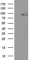 PDE4B Antibody - HEK293T cells were transfected with the pCMV6-ENTRY control (Left lane) or pCMV6-ENTRY PDE4B (Right lane) cDNA for 48 hrs and lysed. Equivalent amounts of cell lysates (5 ug per lane) were separated by SDS-PAGE and immunoblotted with anti-PDE4B.