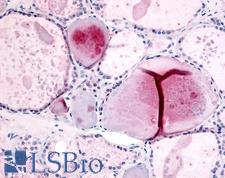PDE8B Antibody - Anti-PDE8B antibody IHC of human thyroid. Immunohistochemistry of formalin-fixed, paraffin-embedded tissue after heat-induced antigen retrieval.