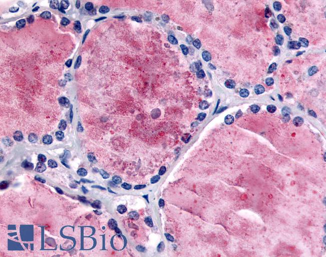 PDE8B Antibody - Anti-PDE8B antibody IHC of human thyroid. Immunohistochemistry of formalin-fixed, paraffin-embedded tissue after heat-induced antigen retrieval.