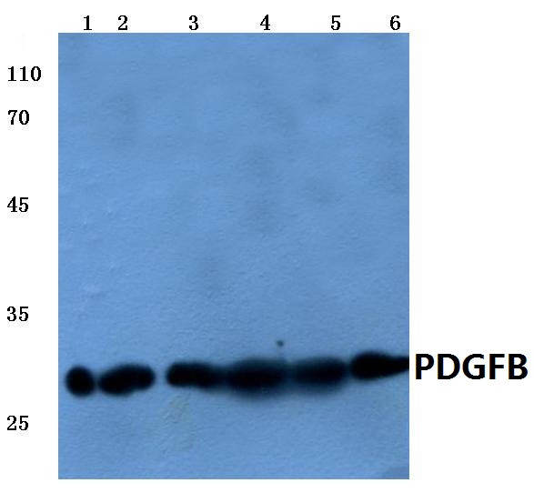 PDGF-BB Antibody - Western blot analysis of PDGFB pAb at 1:500.  Lane 1: HEK293T cell lysate.  Lane 2: HeLa cell lysate.  Lane 3: Mouse liver tissue extract.  Lane 4: Rat liver tissue extract.  Lane 5: Mouse kidney tissue extract.  Lane 6: Rat kidney tissue extract.