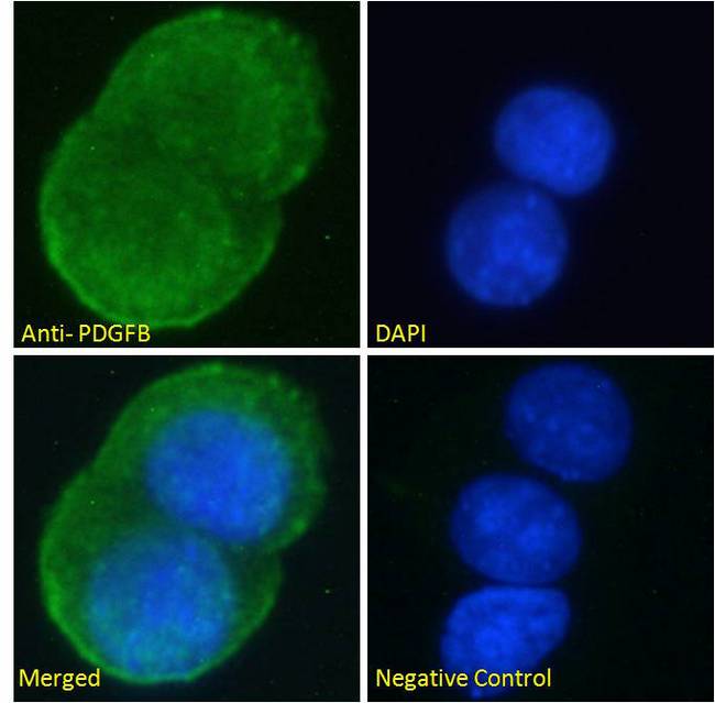 PDGF-BB Antibody - Goat Anti-PDGFB Antibody Immunofluorescence analysis of paraformaldehyde fixed MCF7 cells, permeabilized with 0.15% Triton. Primary incubation 1hr (10ug/ml) followed by Alexa Fluor 488 secondary antibody (2ug/ml), showing vesicle staining. The nuclear stain is DAPI (blue). Negative control: Unimmunized goat IgG (10ug/ml) followed by Alexa Fluor 488 secondary antibody (2ug/ml).