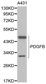 PDGF-BB Antibody - Western blot of PDGFB pAb in extracts from A431 cells.